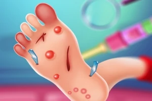 발에 상처와 뾰루지가 있는 일러스트 이미지
