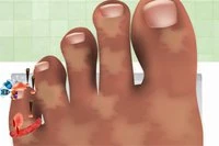 게임 세계에서 간단히 네일 닥터가 되어보세요